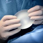 cicatrice après une augmentation mammaire